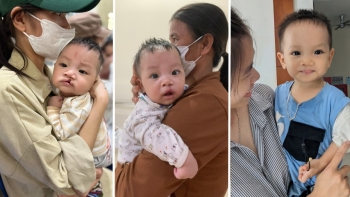 OS khám, phẫu thuật miễn phí cho trẻ em bị dị tật môi, vòm miệng tại Đắk Lắk