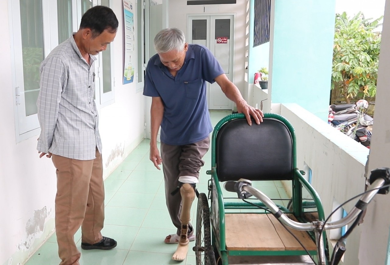 MCNV hỗ trợ làm chân tay giả, giày nẹp chỉnh hình cho người khuyết tật