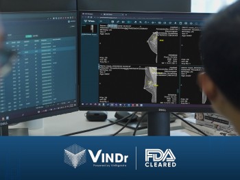 Đạt chuẩn FDA khắt khe, sản phẩm AI của VinBigdata rộng cửa kinh doanh trên toàn cầu