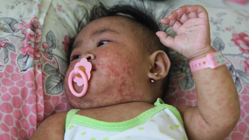 Gần 15 triệu trẻ em không được tiêm chủng vaccine thiết yếu  3