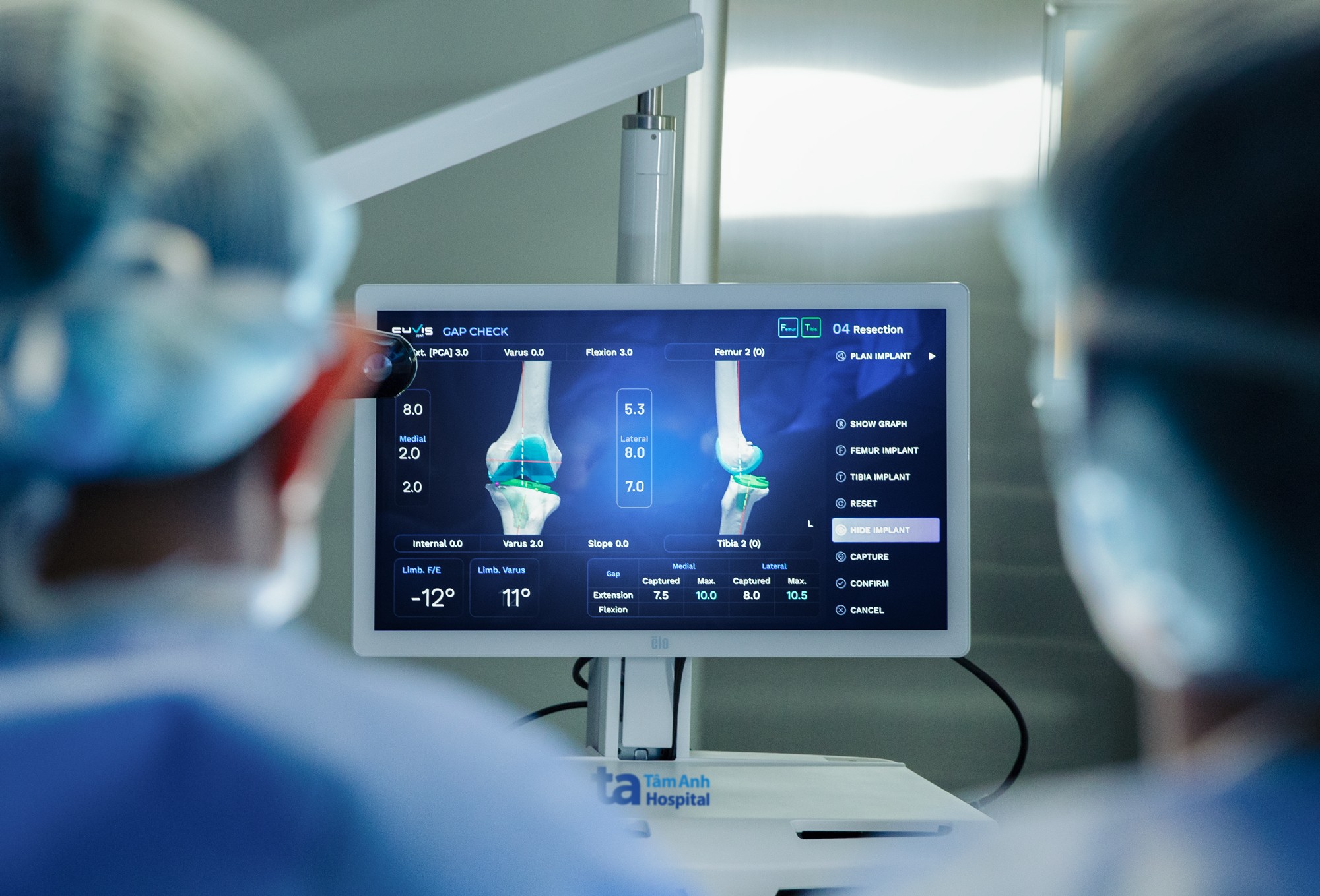 Việt Nam lần đầu có Robot AI thay khớp “siêu thao tác” chuẩn xác