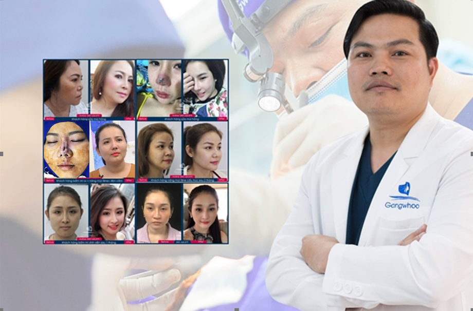 bac si phung manh cuong chuyen gia sua mui hong