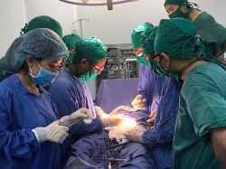 Kỳ cục vòng tránh thai "đi lạc" vào bàng quang của người phụ nữ