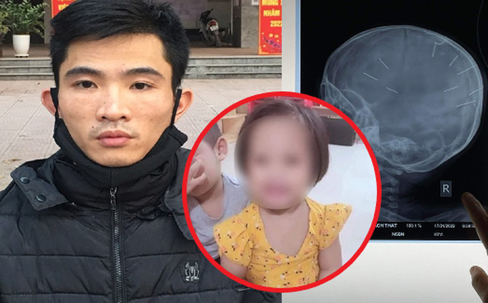 doi tuong dong 9 chiec dinh vao dau chau be 3 tuoi se doi mat voi muc an nao