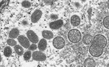 Peru giải mã thành công trình tự gene virus đậu mùa khỉ