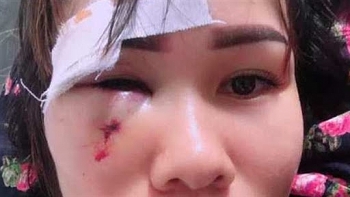 thong tin xa hoi sang 99 chu tich hoi cuu chien binh dam rach mat mot phu nu