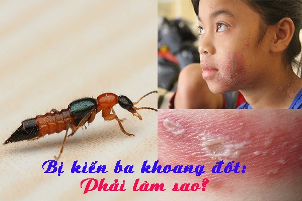 kien ba khoang do bo ha noi doc to manh gap 12 15 lan ran ho mang