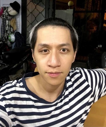 bui duy ngoc bi tai nan nghiem trong liet nua mat va chan thuong nao