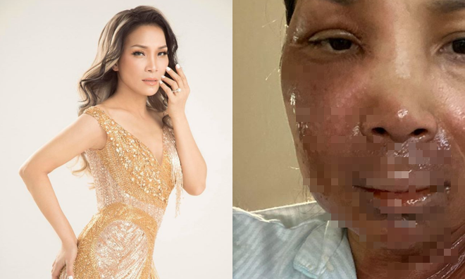 hong ngoc dong cam voi noi dau cua gia dinh bi bong vu chay phong ngu