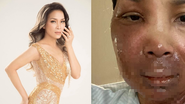 hong ngoc dong cam voi noi dau cua gia dinh bi bong vu chay phong ngu