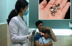 nhet pin dien tu vao tai be trai 5 tuoi bi thung mang nhi