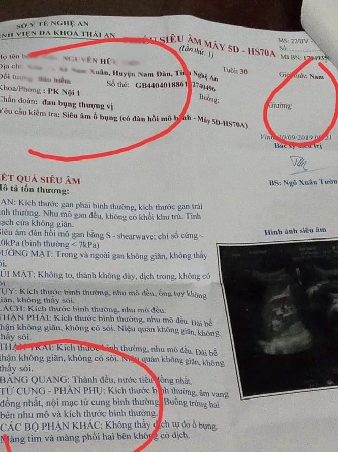 vo bang hoang khi phieu sieu am cua chong co tu cung va buong trung