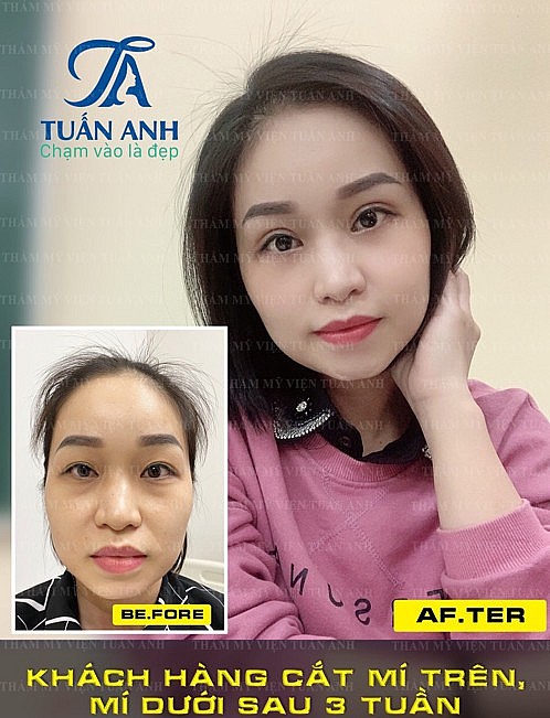Đôi mắt tươi như đang cười biểu hiện trong mắt là biểu tượng của sự lạc quan, vui vẻ. Đuôi mắt hướng lên trên toát lên sự thông minh, nhanh nhẹn.