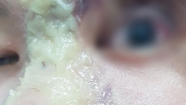 bv dk duc giang benh nhan tu vong sau tiem thuoc giam dau