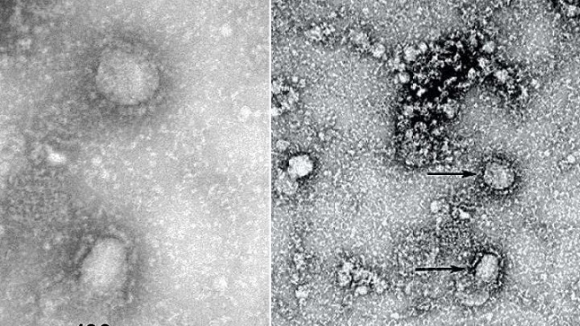 thay thich truc thai minh chua ba vang co the hoa giai virus corona