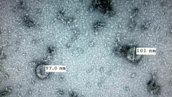 Tin vui: Việt Nam lần đầu nuôi cấy, phân lập thành công virus corona mới