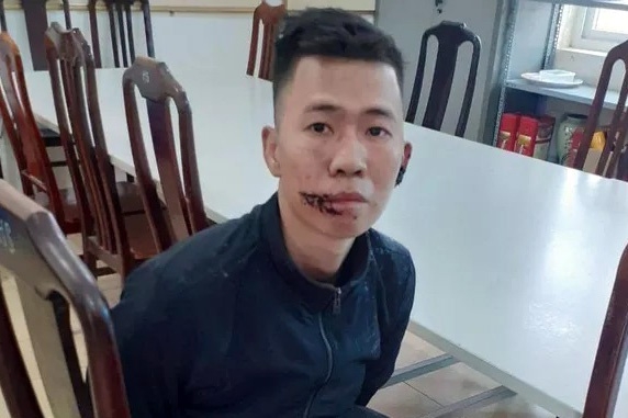 ha noi danh tinh nghi pham chem bo me thuong vong o me linh