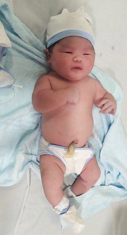 Khánh Hòa: Bé trai nặng 6,5 kg bụ bẫm chào đời thành công khanh hoa be trai nang 65 kg bu bam chao doi thanh cong