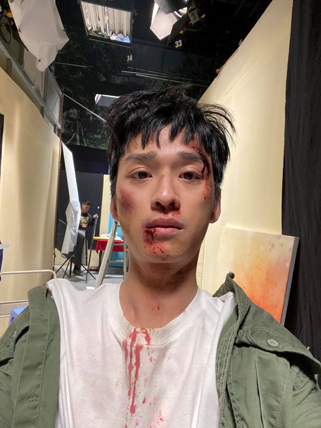 tran nghia thay giao ngan bi danh toi ta trong nha tro balanha