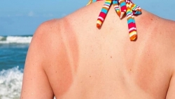 nghe voi mat ong chua dau da day