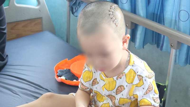 be trai bi lom so vi nga tu gac cao 3m xuong dat