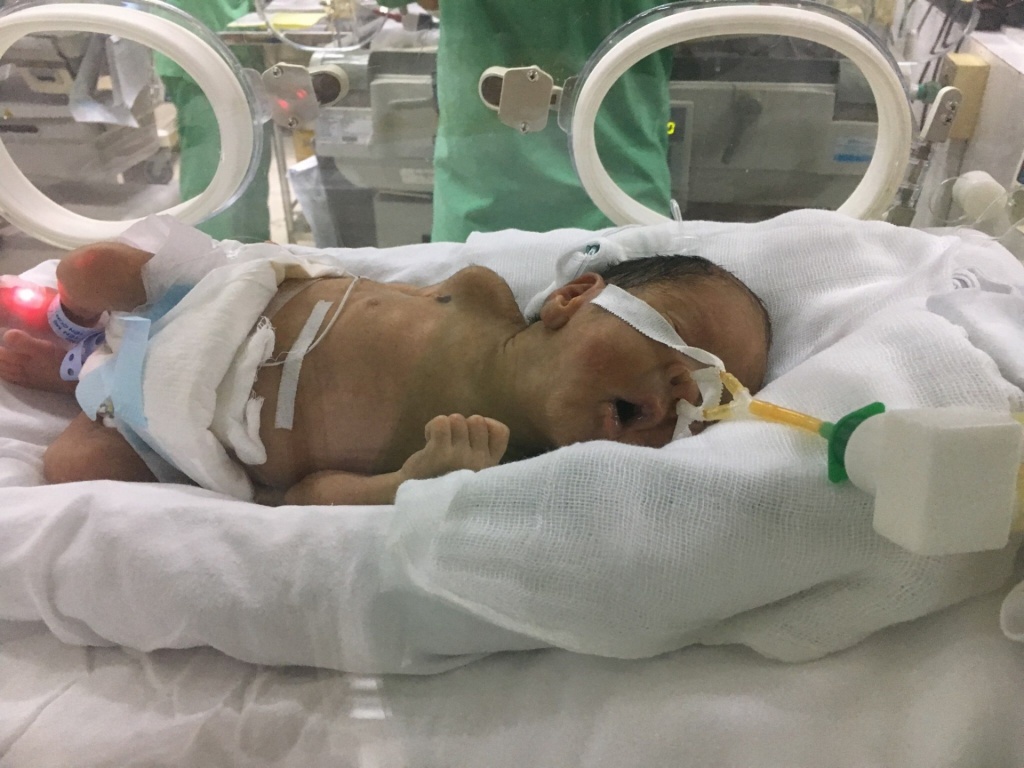 dien bien moi nhat suc khoe ba me ung thu giai doan cuoi van quyet sinh con