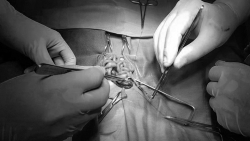 be chao doi can nang 52kg o ha noi