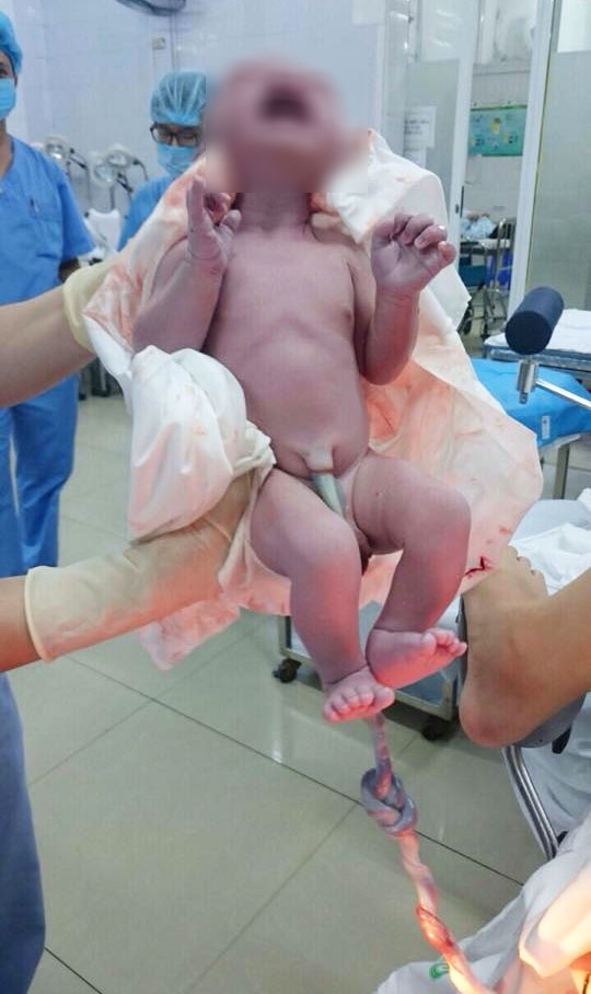 hai phong nhung em be chao doi voi day ron that 5 nut