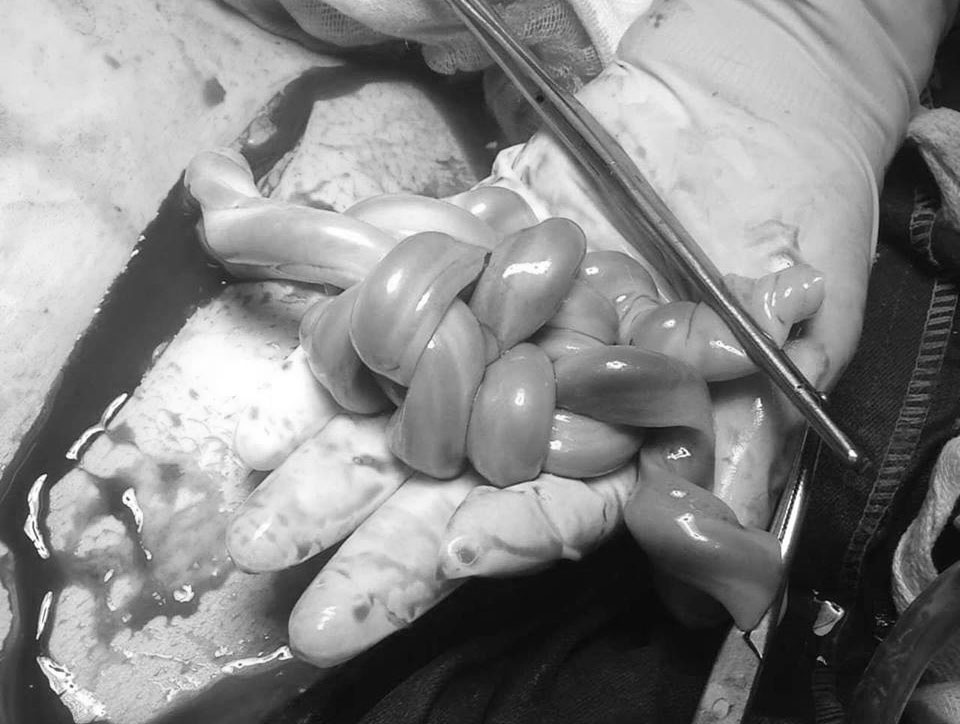 hai phong nhung em be chao doi voi day ron that 5 nut