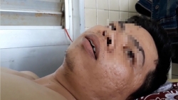 vu benh nhan bi gay xuong nguc nhung khoan nham cang chan benh vien cho ray noi gi