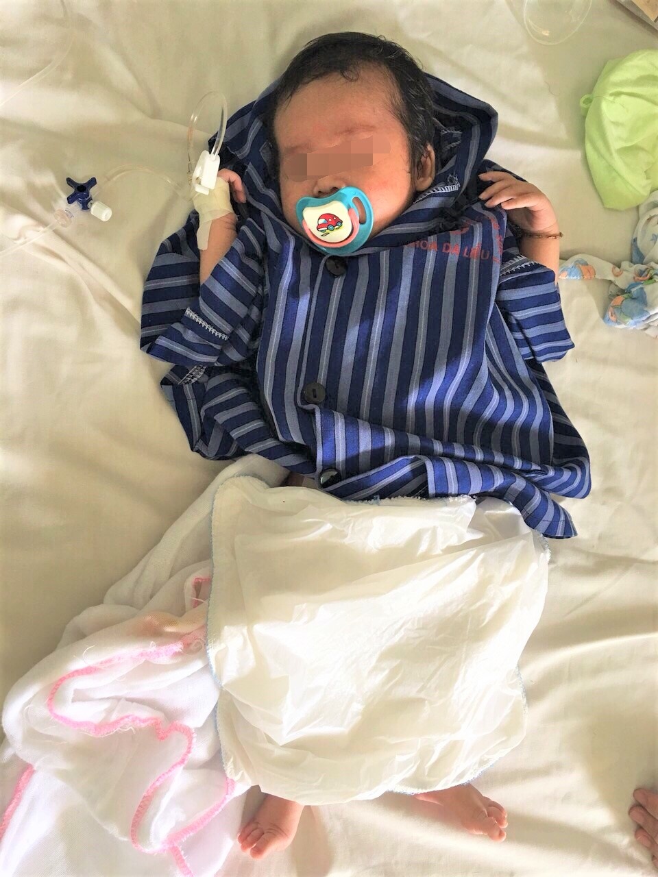 be so sinh 23 ngay tuoi bi thoat vi ben nghen