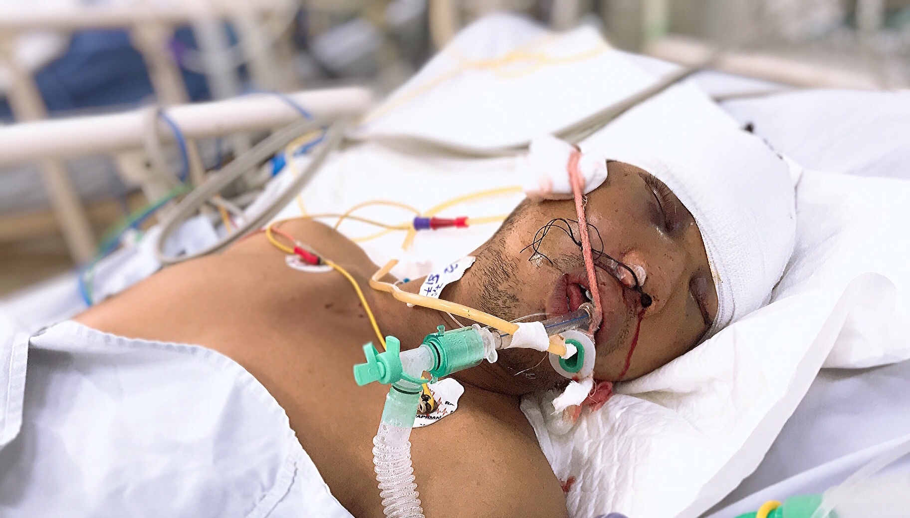 tp hcm tim nguoi than cho be trai 3 tuoi va bo bi tai nan giao thong nghiem trong