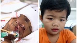 1 nguoi chet 14 nguoi bi thuong khi di xe du lich den bien cua lo