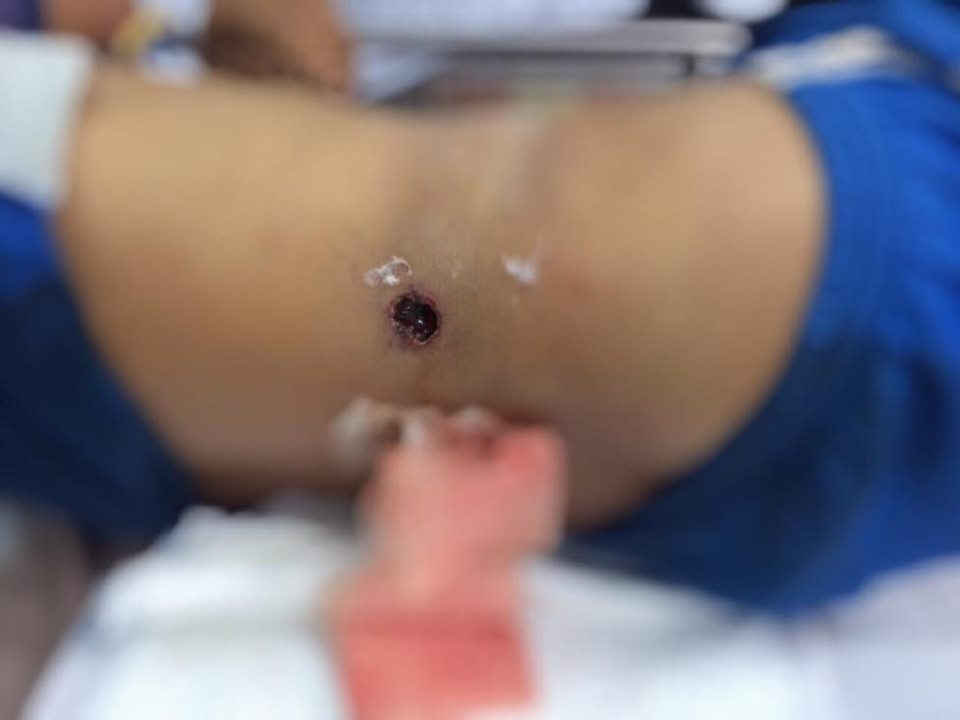 hy huu nga xe may nguoi dan ong bi sung di san cuop co ban thung bung