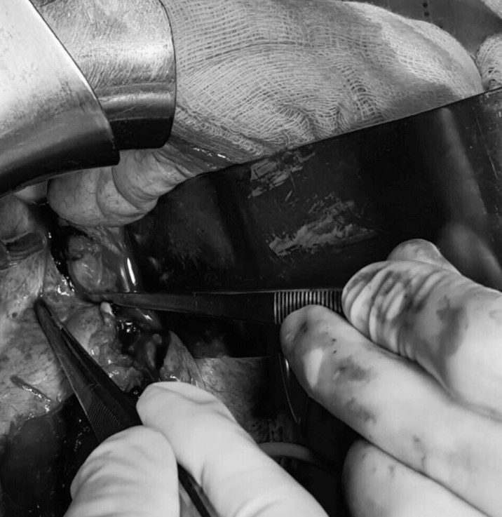 hy huu nga xe may nguoi dan ong bi sung di san cuop co ban thung bung