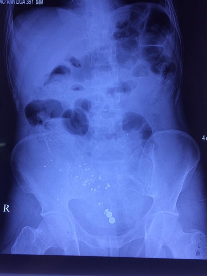 hy huu nga xe may nguoi dan ong bi sung di san cuop co ban thung bung