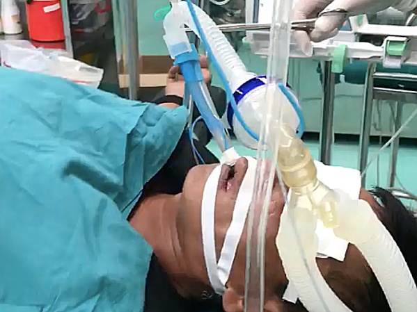 Dùng miệng hút dầu diesel, người đàn ông nguy kịch dung mieng hut dau diesel nguoi dan ong nguy kich