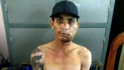 Vì sao nghi phạm bắn người yêu trốn được sau khi vào bệnh viện?