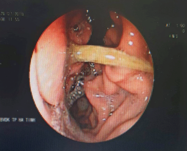 hy huu tam chui tot vao da day vi thoi quen ngam tam truoc khi ngu