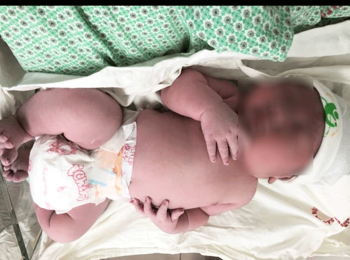 be chao doi can nang 52kg o ha noi