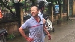 he lo nguyen nhan vu tham an khien 5 nguoi thuong vong o dan phuong