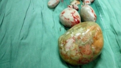 nhin tieu tu vung tau ve tphcm nguoi dan ong truot chan te vo bang quang