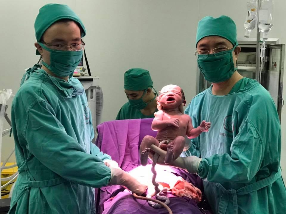 can canh cap sinh doi chao doi con nguyen trong boc oi