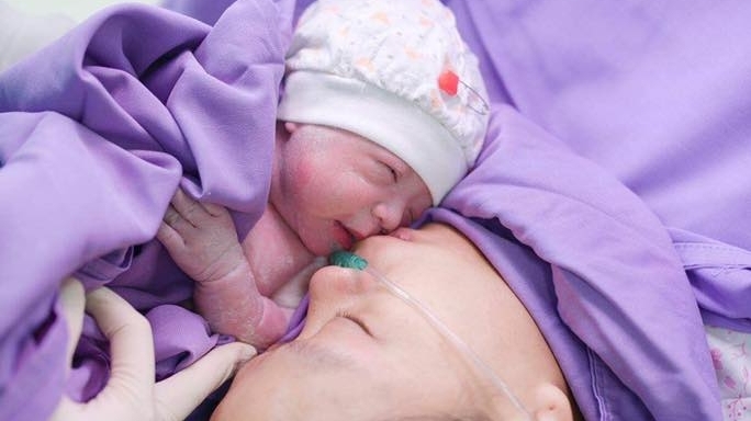 Cận cảnh cặp sinh đôi chào đời còn nguyên trong bọc ối