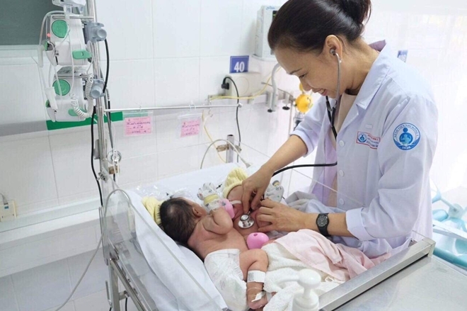 can canh ca phau thuat tach roi cap sinh doi dinh lien bung hon 1 thang tuoi