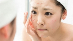 bi kip cham soc da tuoi day thi de tro thanh hot girl hoc duong