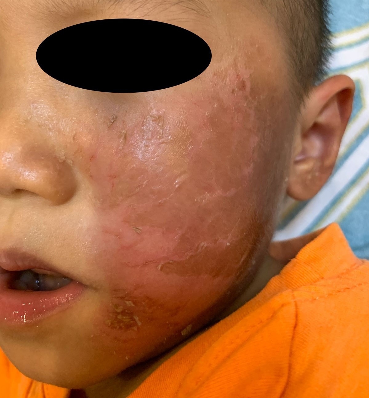 hoa trang halloween be 4 tuoi bi bong rop mat