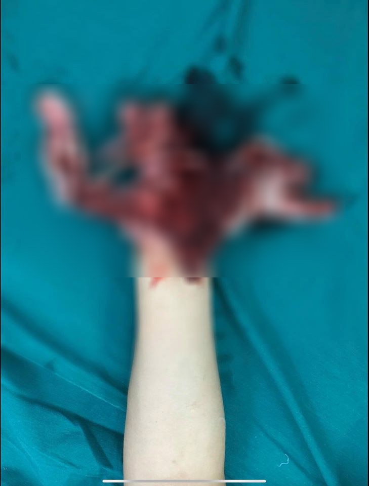 vua sac dien thoai vua dung thanh nien bi no nat ban tay