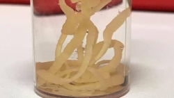 nam bac si bi to om nu sinh thuc tap ngu trong ca truc