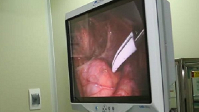 nguoi dan ong nguy kich vi nuot luon song chua tao bon